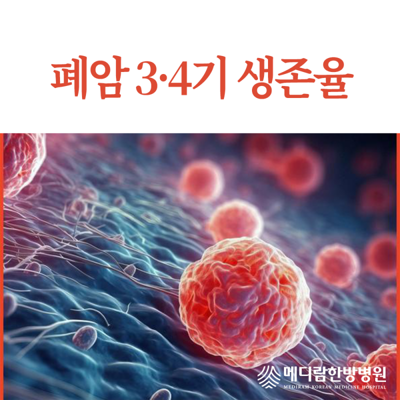 폐암 3기 4기 생존율, 어떻게 치료해야 할까요?