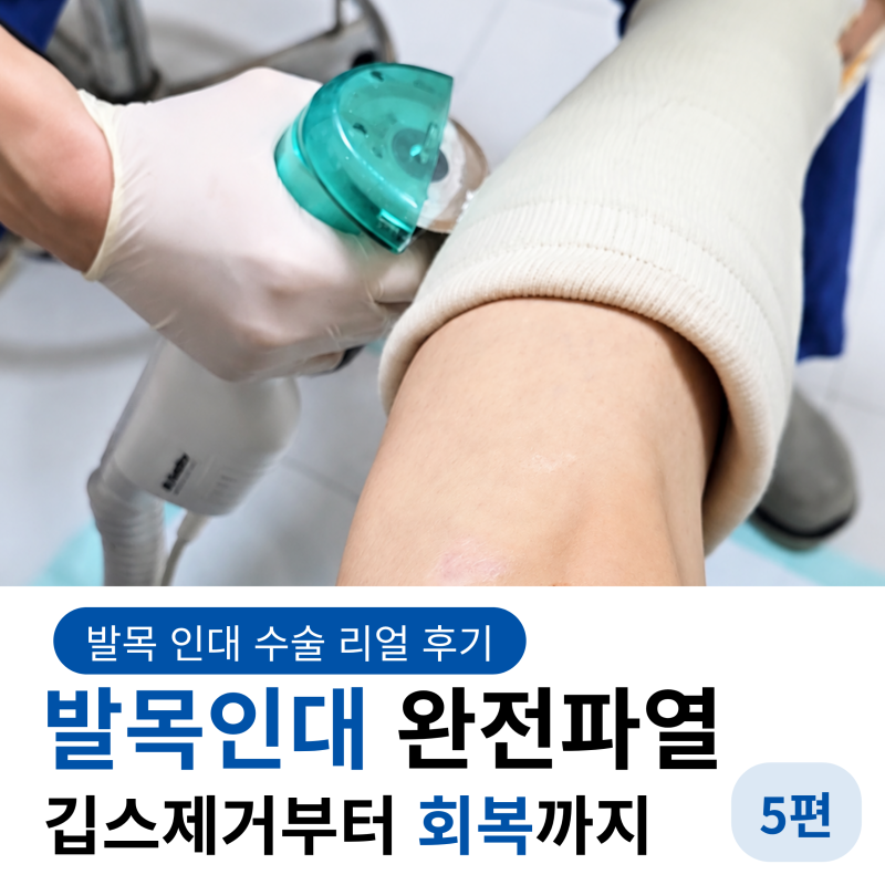 발목 인대 완전파열 수술 후기 마지막｜깁스 제거부터 회복, 실비 청구까지