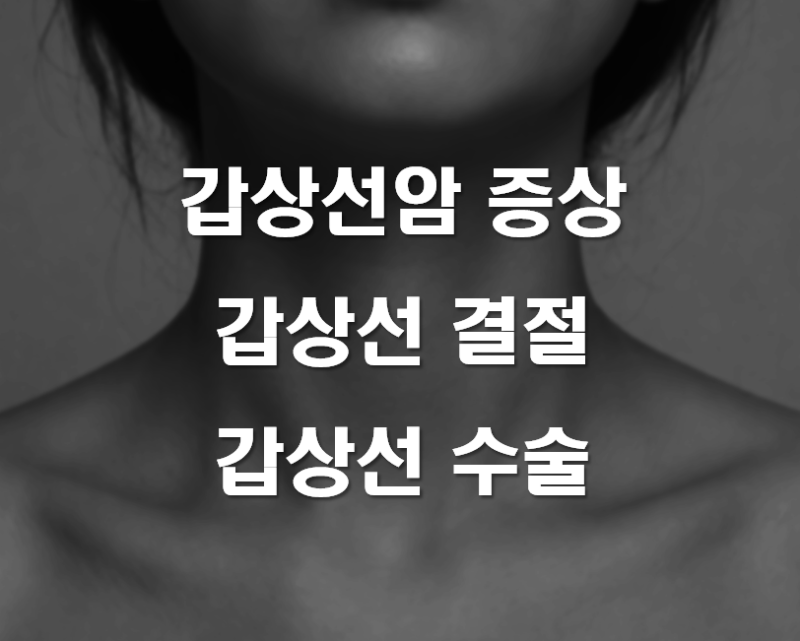 갑상선암 증상｜초기증상·수술비 보험