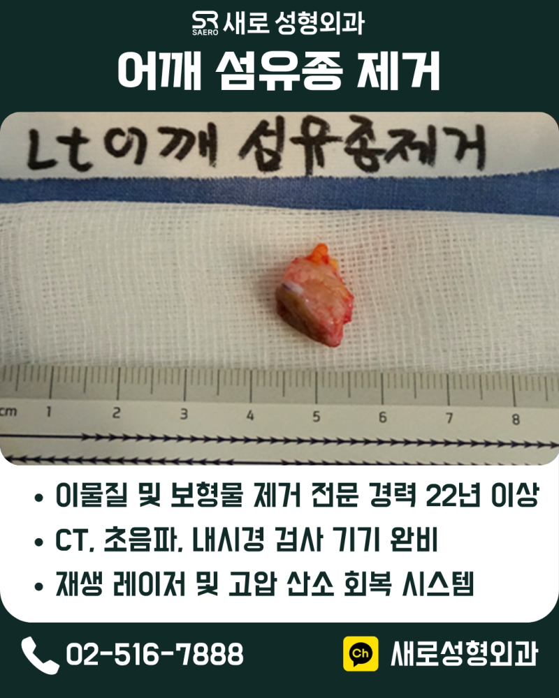 피부섬유종 제거 흉터 고민은 실비 가능 성형외과로