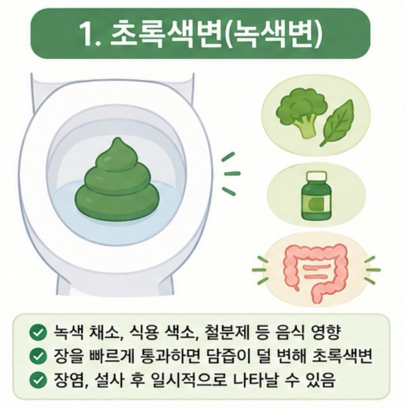 대변색깔이 이상했습니다, 초록색변 검정색변 흰색변 점액변 원인과 대변냄새 체크