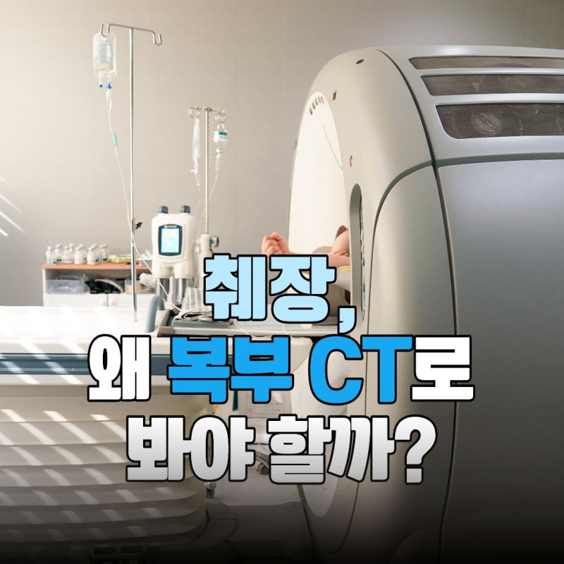 췌장이 걱정된다면 복부 CT를 고려해야 하는 이유