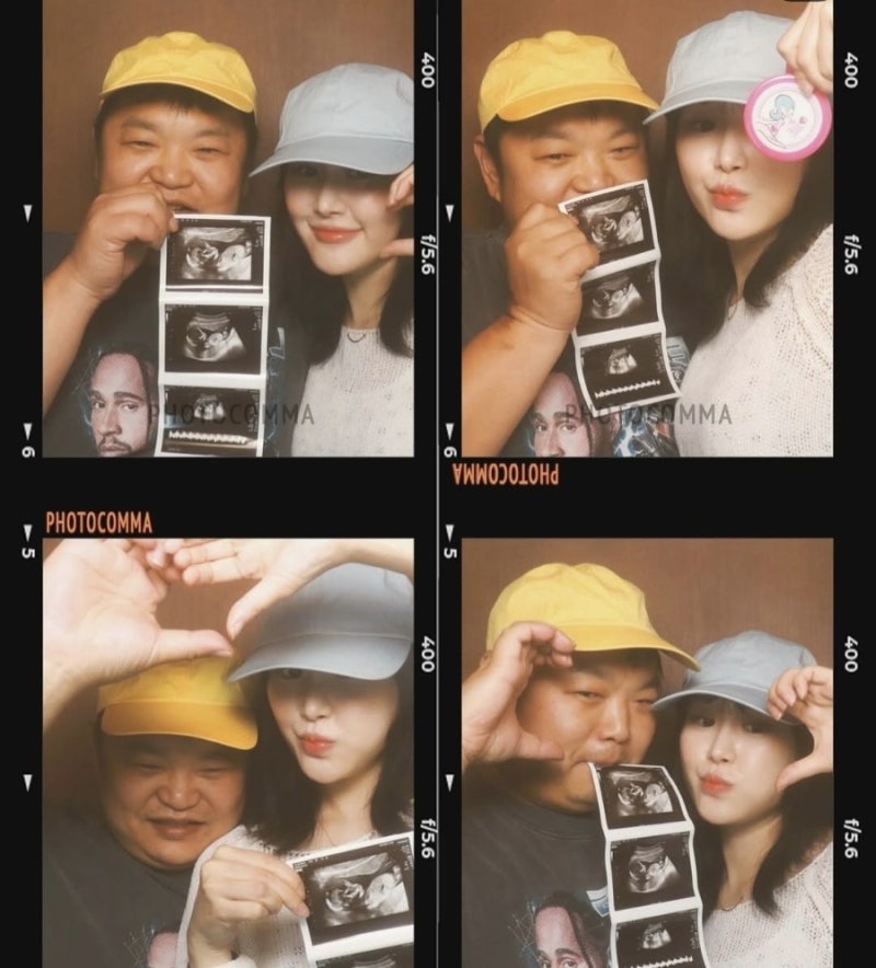 고규필♥에이민, 결혼 3년 만에 찾아온 기적…임신 4개월 초음파 사진 공개