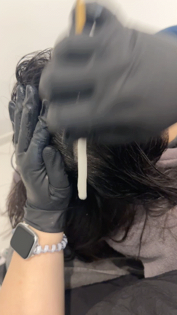 분당 두피관리 추천 더마힐MGF 분당야탑점 솔직후기