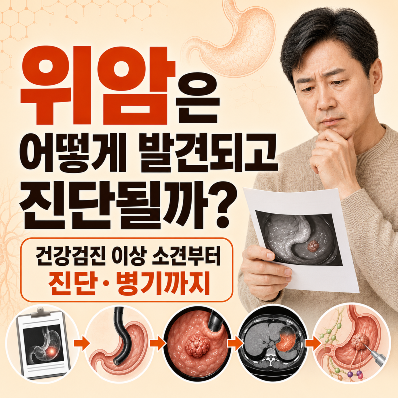 위암은 어떻게 발견되고 진단될까? 건강검진 이상 소견부터 1기·2기·3기·4기 증상과 생존율....