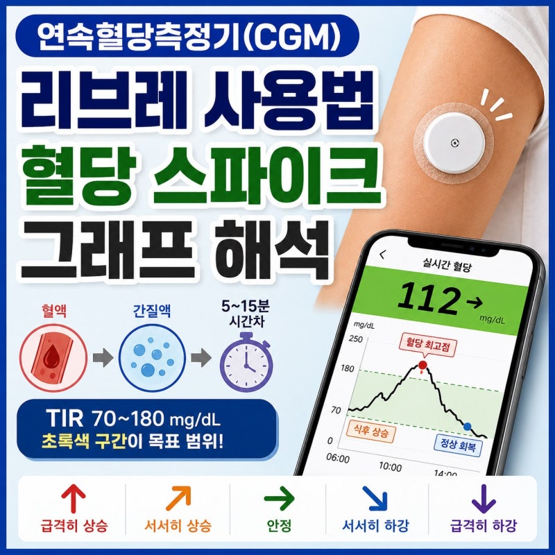 연속혈당측정기(CGM) 사용법, 리브레 그래프 보는 법과 혈당 스파이크 해석