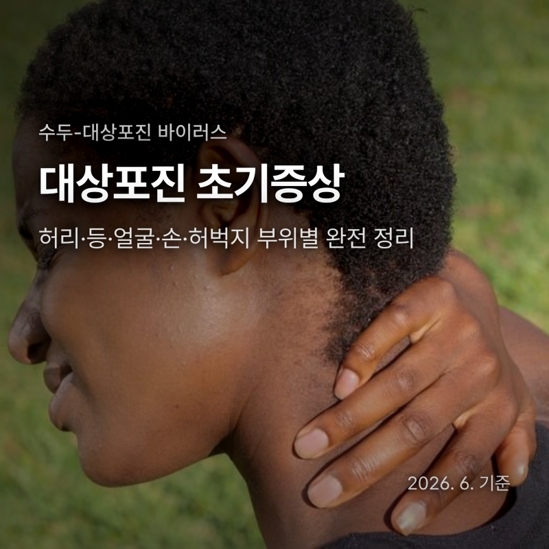 대상포진 초기증상, 허리·등·얼굴·손·허벅지 부위별로 다릅니다