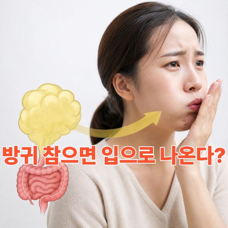 "방귀 참으면 입으로 나온다?" 배에 가스 차는 이유와 당장 빼는 초간단 자세 총정리
