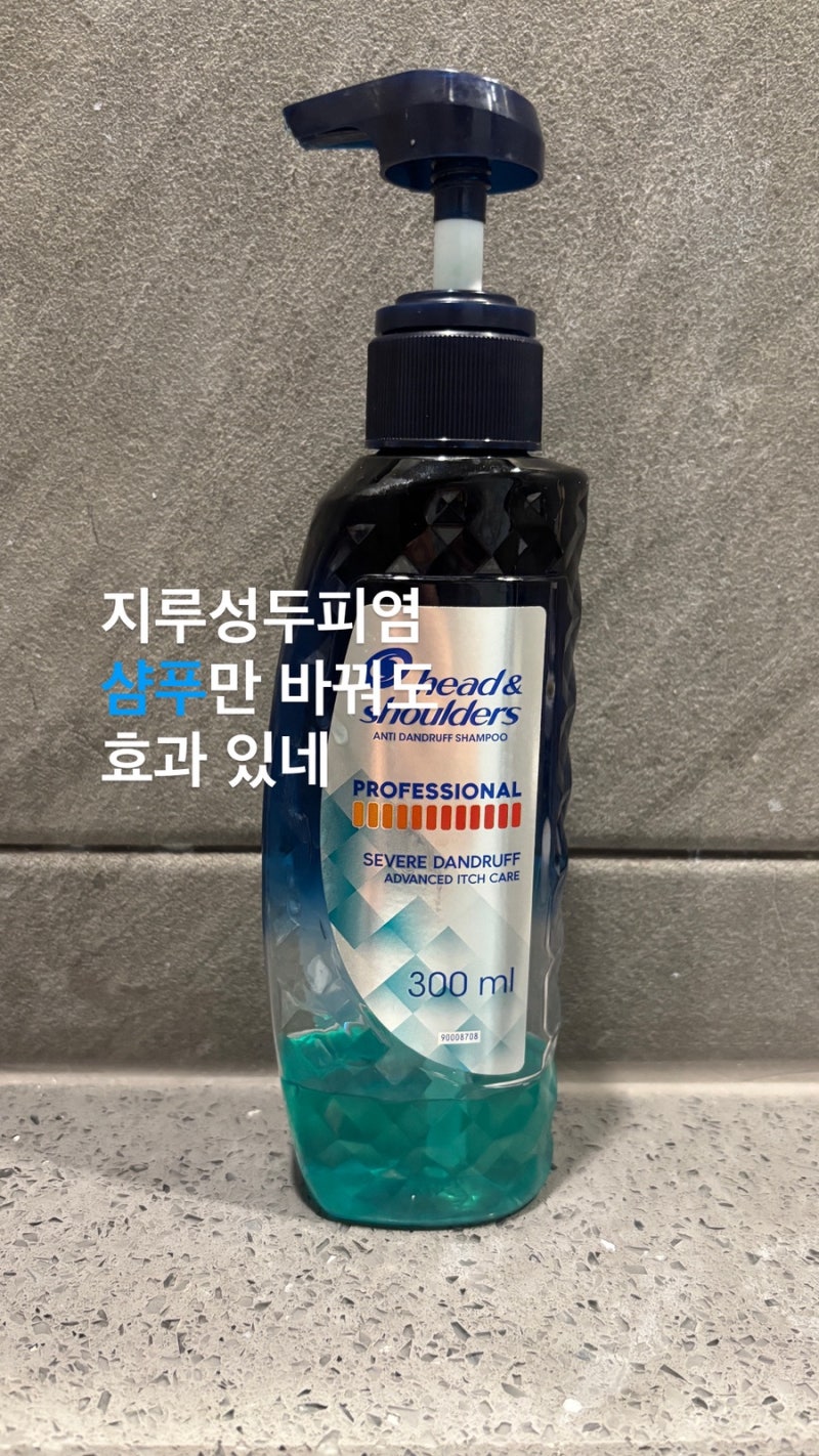 남성 탈모 걱정이면 지루성두피염 관리에 좋은 샴푸 헤드앤숄더 프로페셔널 한달 사용 후기