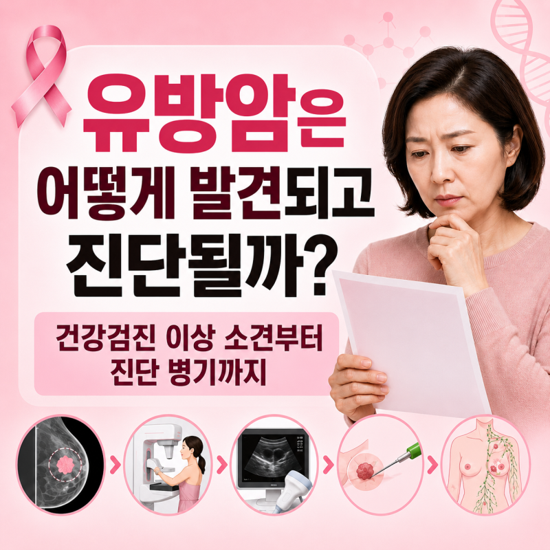 유방암은 어떻게 발견되고 진단될까? 건강검진 이상 소견부터 1기·2기·3기·4기 증상과 생존....