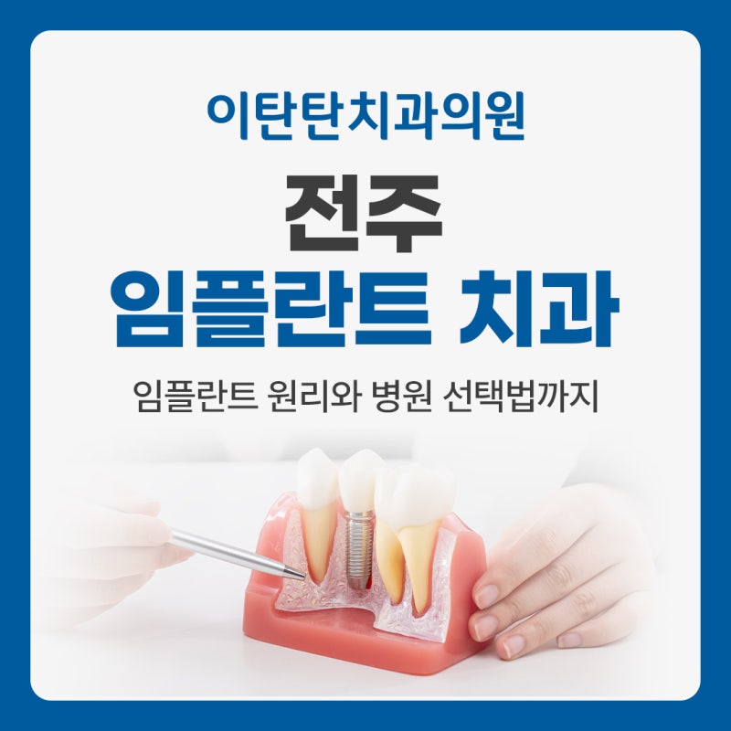 전주 임플란트 치과 선택 전에 반드시 확인해야 하는 것들