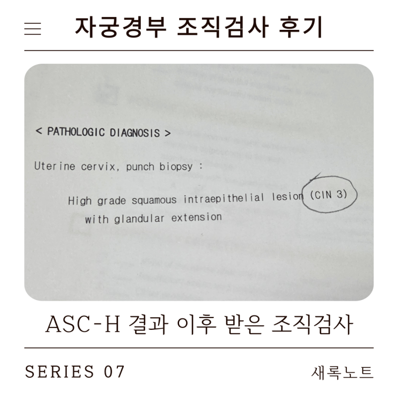 자궁경부 조직 검사 후기 | ASC-H 결과 후 직접 받아본 통증·출혈 기록