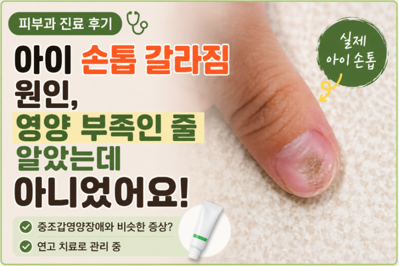 아이 손톱,발톱 갈라짐 원인, 영양 부족이 아니었어요 (피부과 진료 후기)