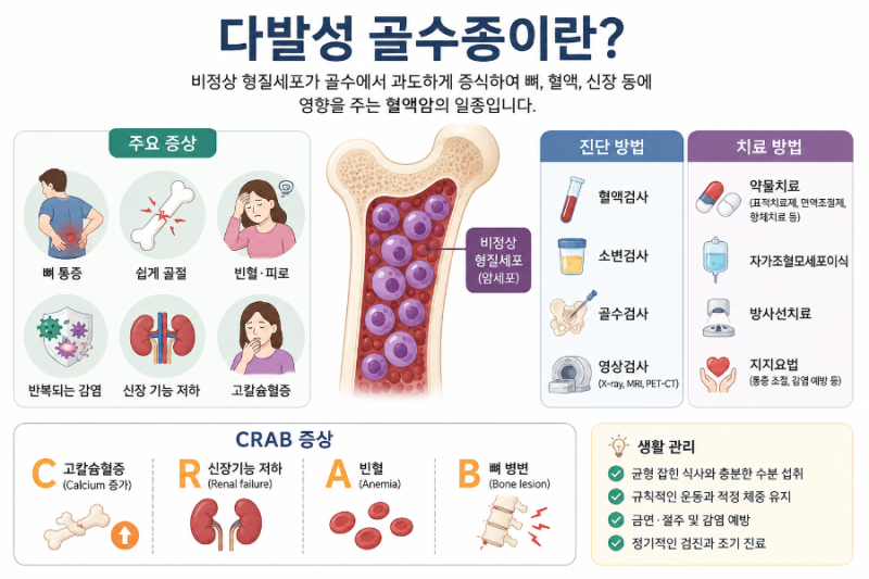 "단순한 피로인 줄 알았는데...허리 통증이 계속된다면?" 잦은 뼈 통증과 골절, '다발성 골수....