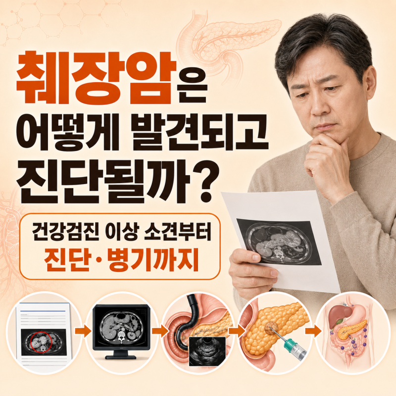 췌장암은 어떻게 발견되고 진단될까? 건강검진 이상 소견부터 1기·2기·3기·4기 증상과 생존....