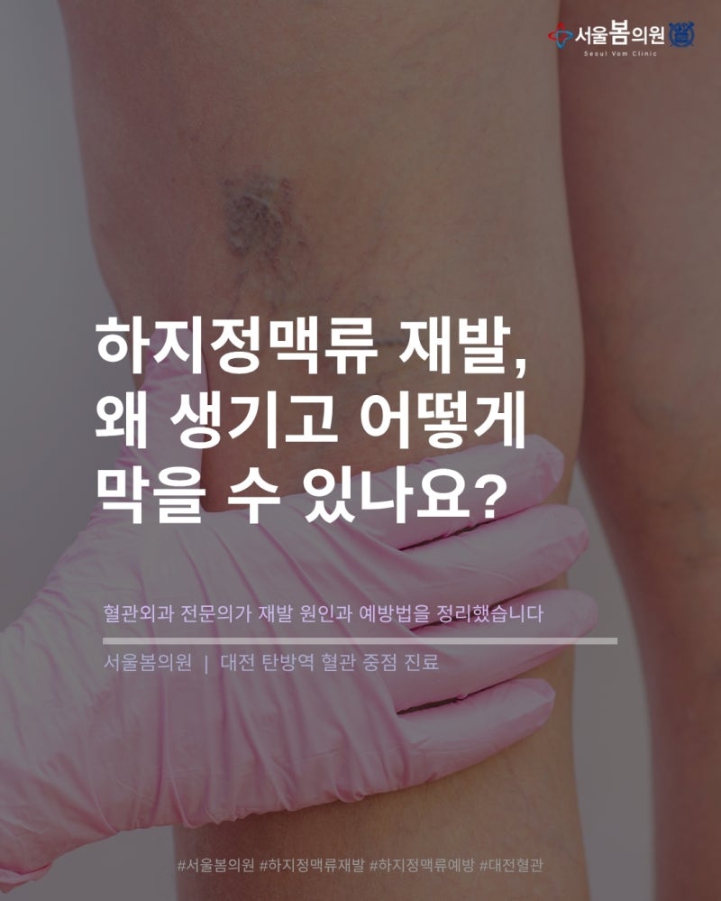 대전 하지정맥류 병원, 재발 원인과 예방법은? | 서울봄의원