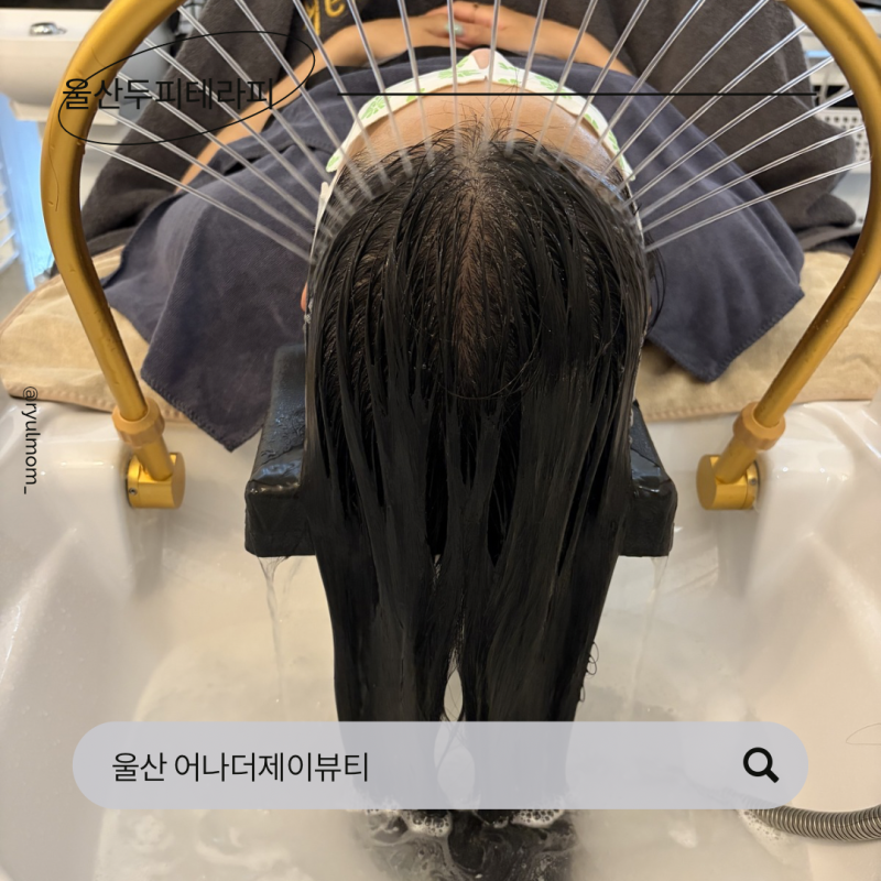 울산 중구 헤스드파 어나더제이 울산두피관리 추천