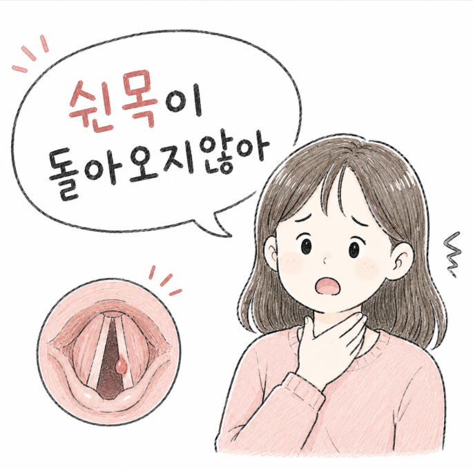 목이 쉰 줄 알았는데? 방심하다 대학병원 가게 만든 성대폴립 증상과 수술후기