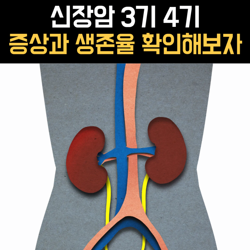신장암 3기 4기 증상과 생존율, 왜 이렇게 차이가 클까요