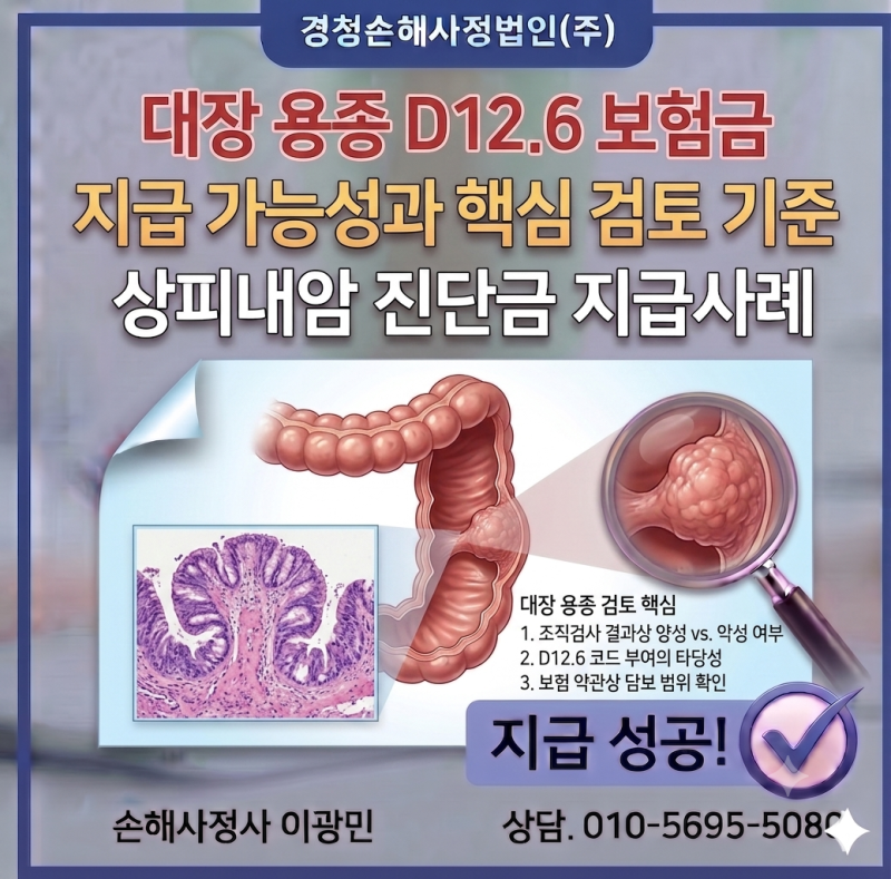 대장 용종 D12.6 보험금, 지급 가능성과 핵심 검토 기준 (결장의 양성 신생물 수술비 정당하게 ....