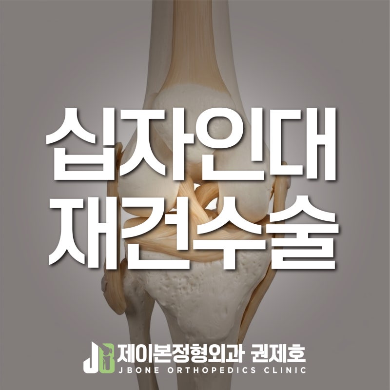 전방십자인대재건술, 끊어진 인대를 다시 잇는 수술은 아닙니다