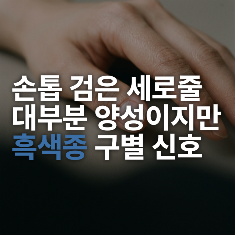 손톱 검은 세로줄, 대부분 양성이지만 흑색종 구별 신호 6가지