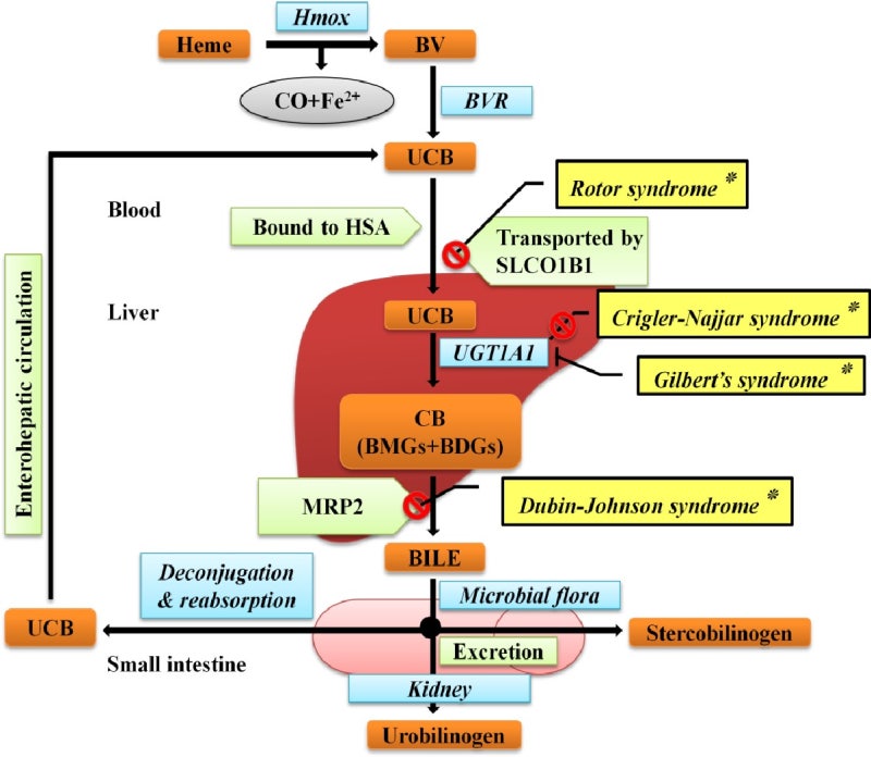 길버트 증후군(Gilbert syndrome, 질베르 증후군)