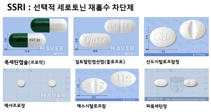 범불안장애 극복 약으로 가능할까요? -한의사 답변