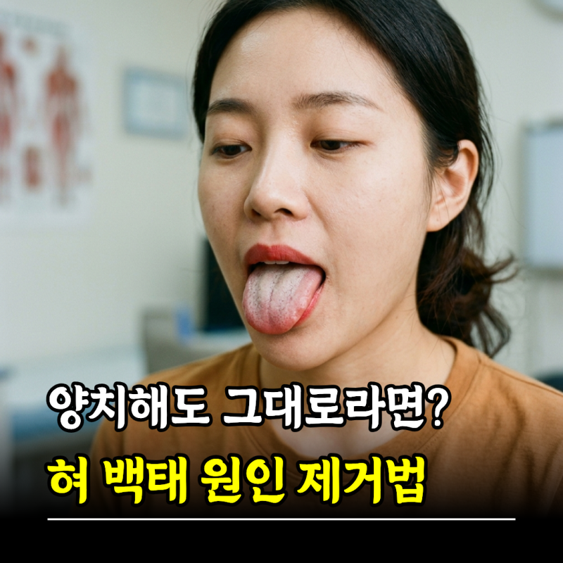 양치해도 그대로라면? 혀 백태 원인 제거방법