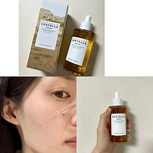화장 착붙 앰플 추천 스킨1004 마다가스카르 센텔라 앰플 건성 사용후기