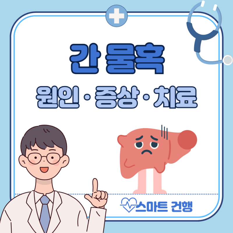간 물혹 원인, 증상, 치료, 수술 : 간에 혹, 간낭종이란?