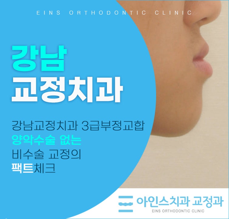 3급부정교합 양악수술 없는 비수술 교정의 팩트체크