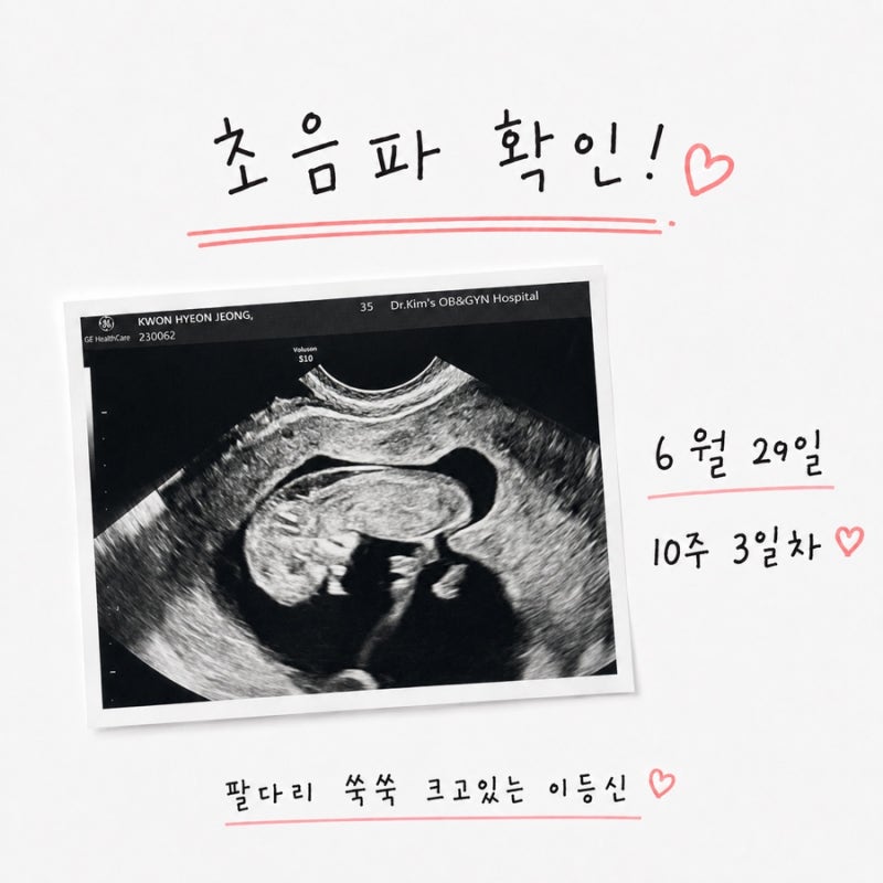 임신 9주차 결혼식 | 임신초기 신혼여행(오키나와) 후기