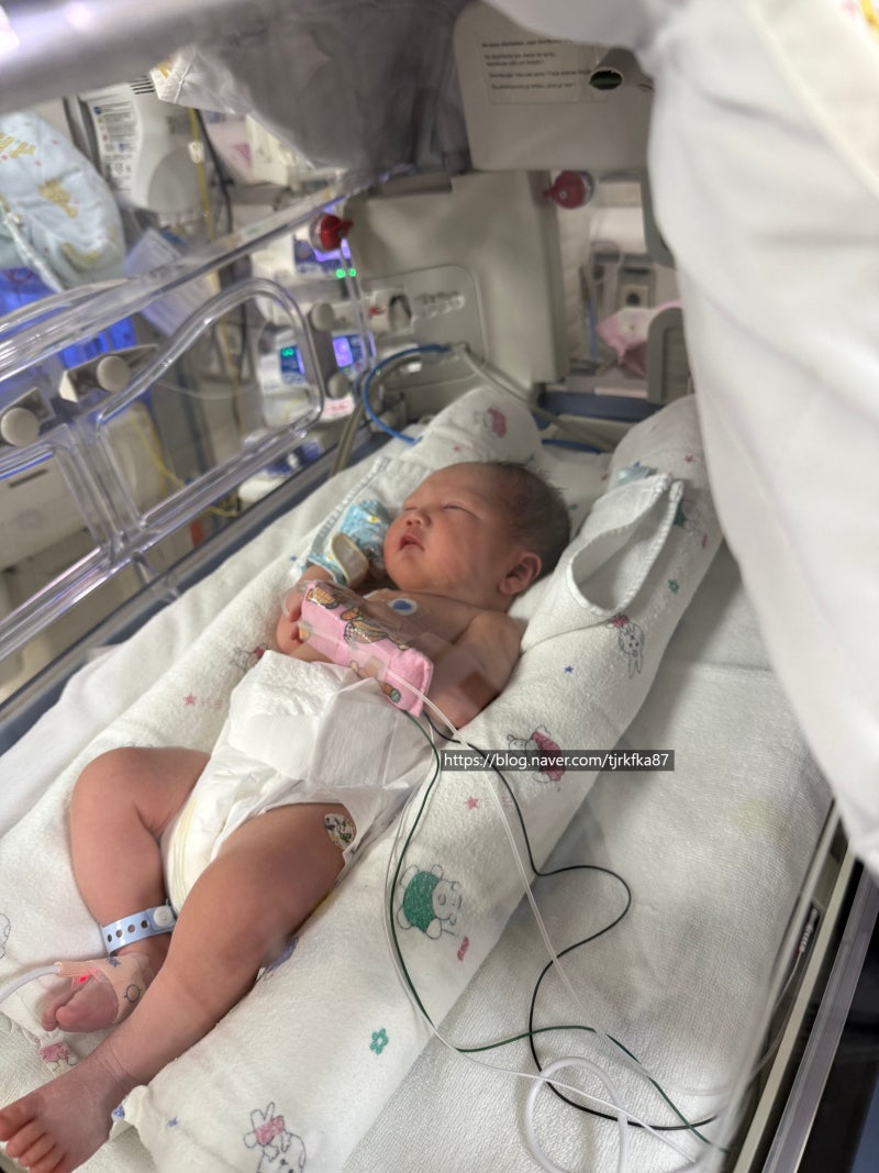 미숙아 기준 이른둥이 칠삭둥이 뜻부터 신생아 중환자실(NICU) 지원금까지