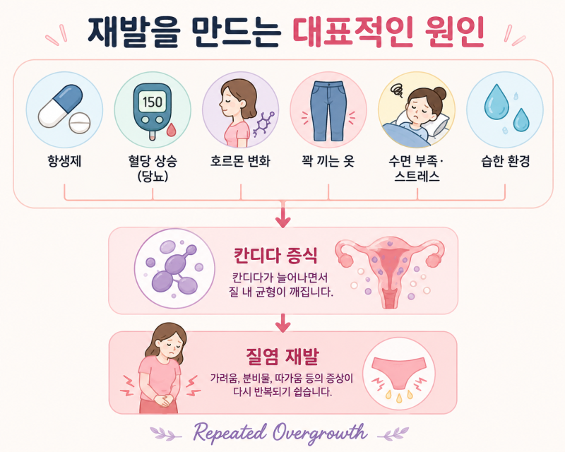칸디다 질염이 자꾸 반복돼요. 왜 계속 재발할까요?
