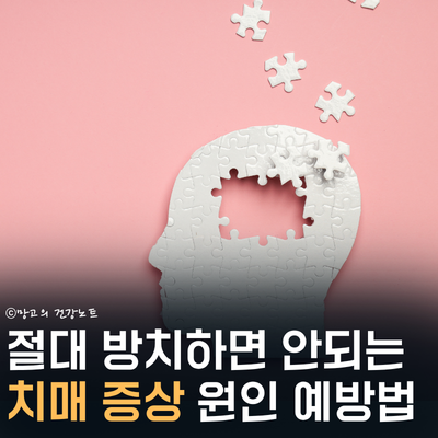 절대 방치하면 안되는 치매 증상 3가지! 원인과 예방법은?