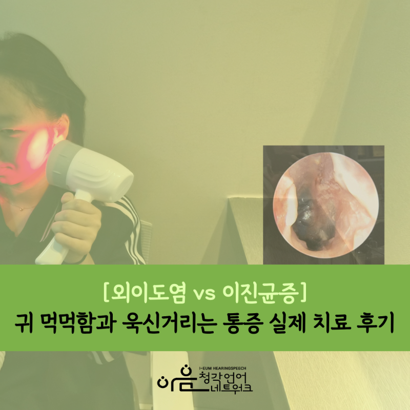 [외이도염/이진균증] 귀 먹먹함과 욱신거리는 통증 실제 치료 후기