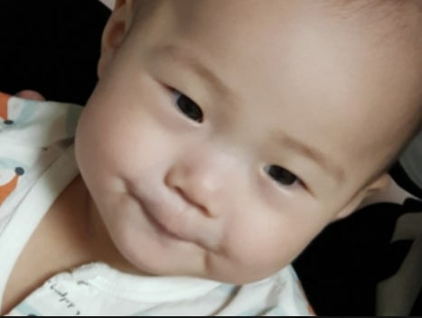 소아 장중첩증 증상과 원인, 아이배아플 때 알아야 할 치료방법
