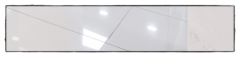 부천시청역치과 바쁘거나 귀찮다는 이유로 치료 미룬다면