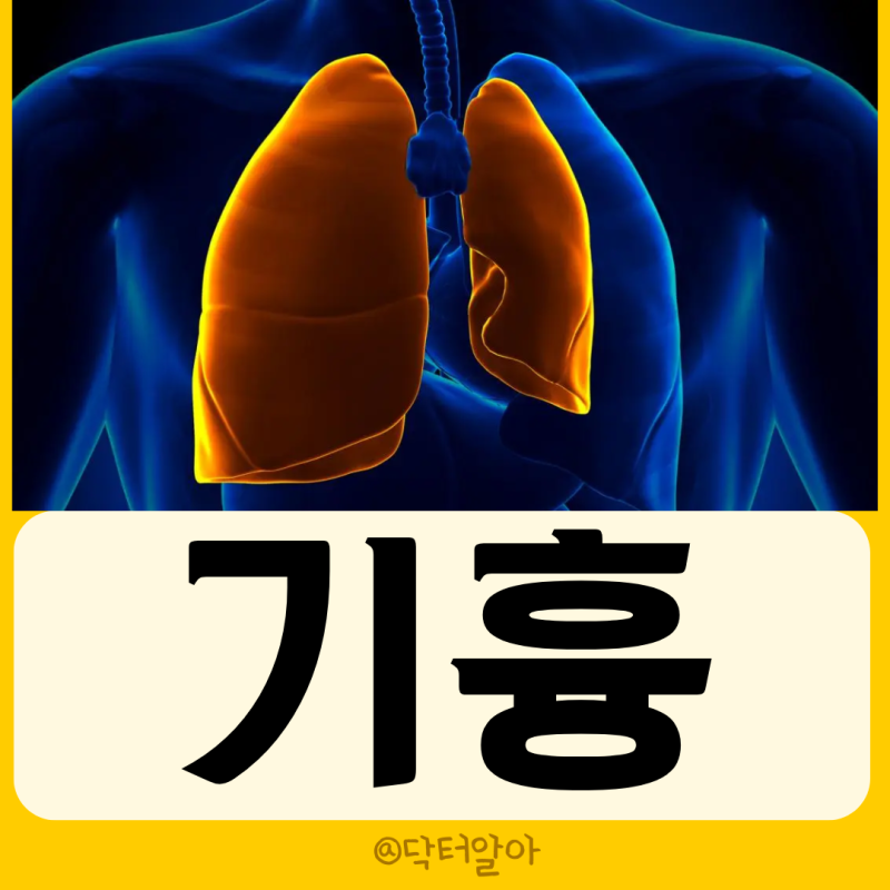의사가 설명하는 기흉 정의 증상 원인 진단 치료 예방