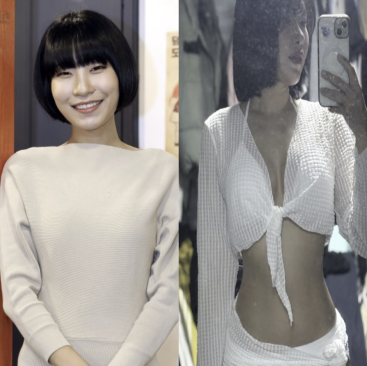 "성형에만 1억" <b>개그우먼</b> <b>이세영</b>, 최근 몰라보게 바뀐 얼굴... 