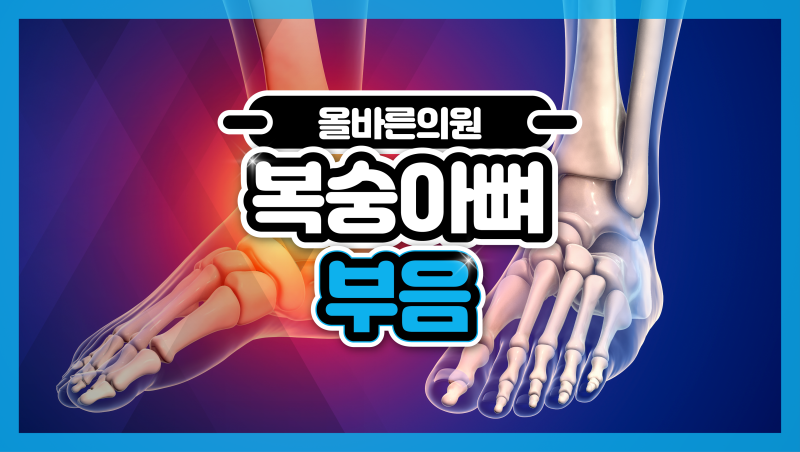 복숭아뼈 부음 아래 통증 나타나면 뼈 문제?