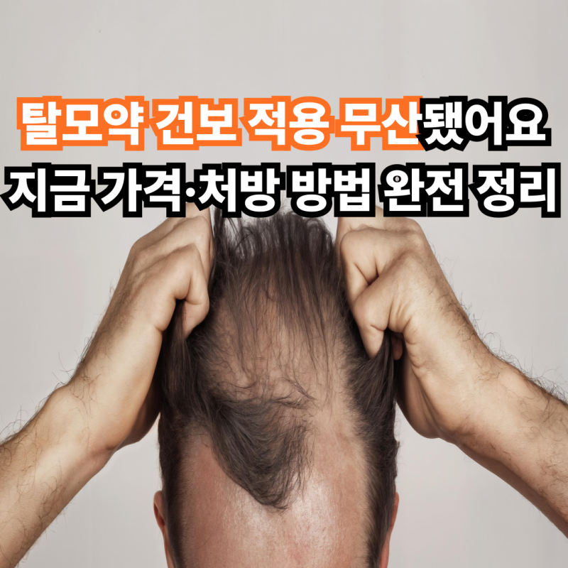 탈모약 건보 적용 무산됐어요 지금 가격·처방 방법 완전 정리