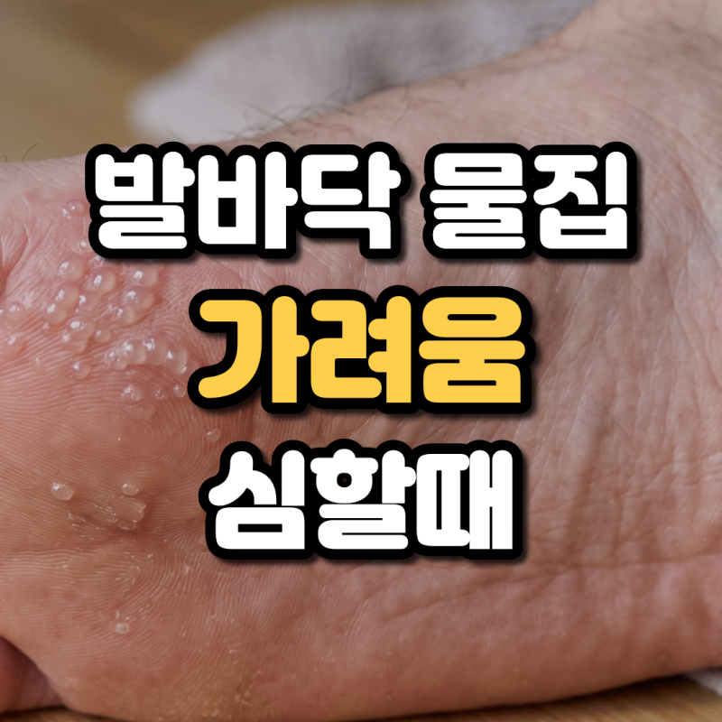 발바닥 물집 가려움 수포성 무좀과 한포진 증상 구별법 총정리