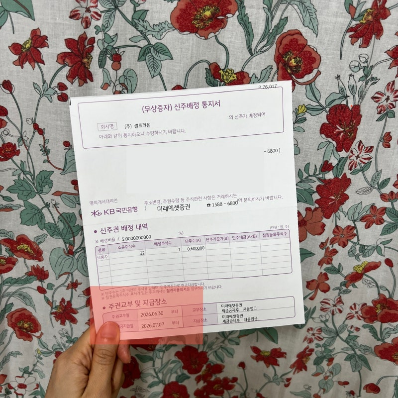 셀트리온 무상증자 단주 처리 후기 : 32주 보유자 실제 사례와 입금 시기 확인