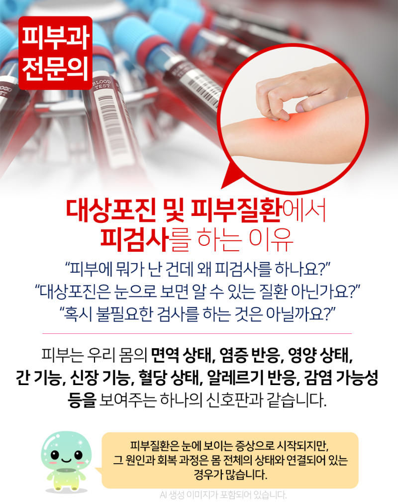 진주 대상포진 및 피부질환에서 피검사를 하는 이유