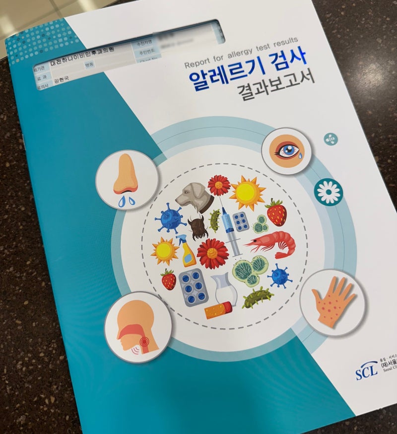MAST 알러지 검사 후기(비용, 병원, 실비)