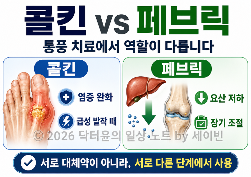 통풍약 콜킨과 페브릭, 어떤 차이가 있고 언제 먹어야 할까요?