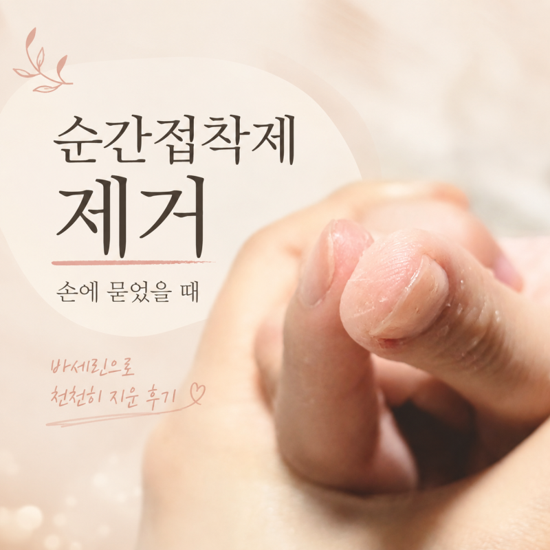 물에 씻지 마세요! 순간접착제 손에 묻었을 때 30초 해결법