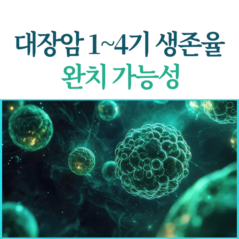 대장암 1기 2기 3기 4기 생존율, 완치율은 얼마나 될까?